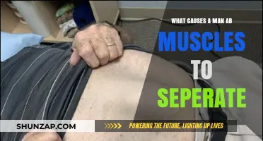 Why Men's Ab Muscles Separate: Causes and Prevention Explained