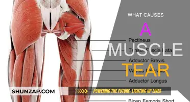 Understanding Muscle Tears: Causes and Prevention