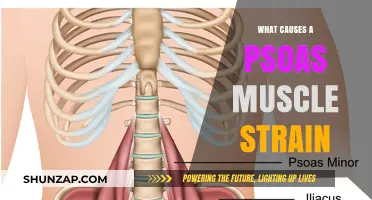 Understanding Psoas Muscle Strain: Causes, Symptoms, and Prevention Tips