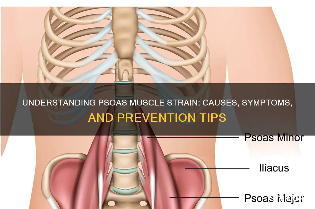 what causes a psoas muscle strain