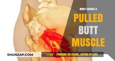 Understanding Pulled Butt Muscle Causes: Prevention and Recovery Tips