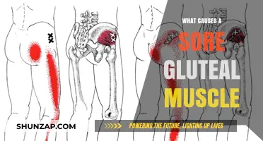 Understanding Sore Gluteal Muscles: Causes and Effective Relief Strategies