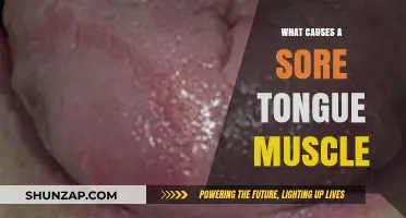 Understanding Sore Tongue Muscles: Causes, Symptoms, and Effective Remedies
