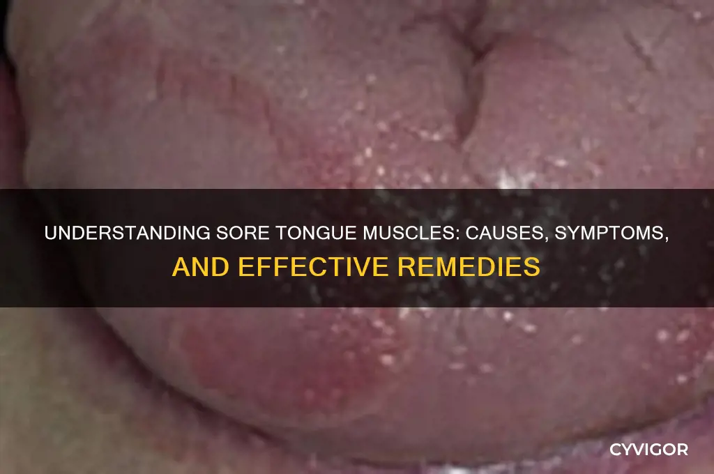 what causes a sore tongue muscle