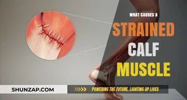 Understanding Strained Calf Muscles: Causes, Prevention, and Recovery Tips