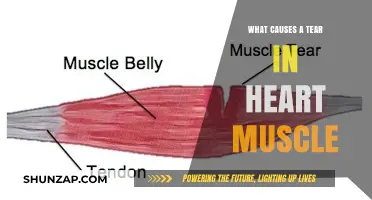 Understanding the Causes of a Tear in Heart Muscle