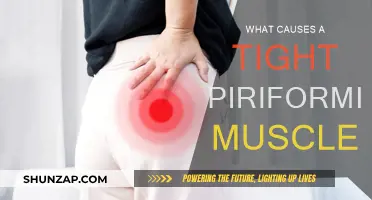 Tight Piriformis Muscle: Causes and Triggers Explained