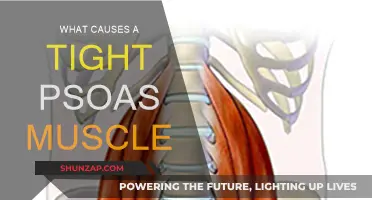 Tight Psoas Muscle: Causes and Solutions