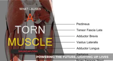 Understanding Muscle Tears: Causes and Prevention