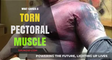 Understanding Torn Pectoral Muscles: Causes, Risks, and Prevention Strategies