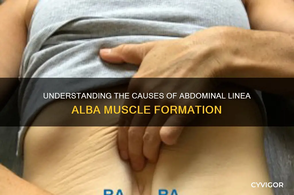 what causes abdominal line muscle