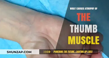 Understanding Thumb Muscle Atrophy: Causes and Contributing Factors Explained