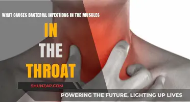 Understanding Bacterial Infections: Causes of Muscle-Related Throat Infections
