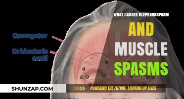 Understanding Blepharospasm and Muscle Spasms: Causes and Triggers Explained