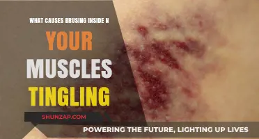 Unraveling Muscle Bruising and Tingling: Causes and Concerns Explained