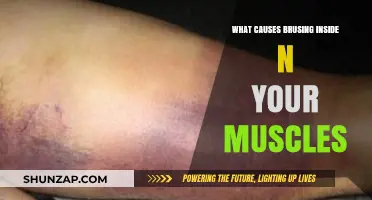 Understanding Muscle Bruising: Causes and Prevention Tips