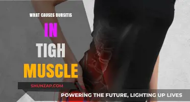 Understanding Bursitis: Causes of Hip Pain in Thigh Muscles
