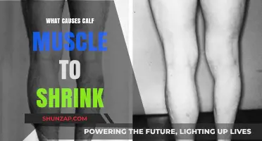 Understanding Calf Muscle Atrophy: Causes and Prevention Strategies