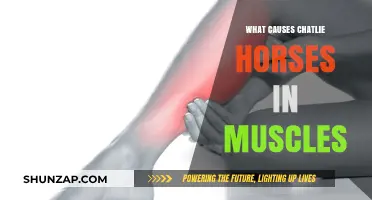 Understanding Charley Horses: Causes of Sudden Muscle Cramps Explained