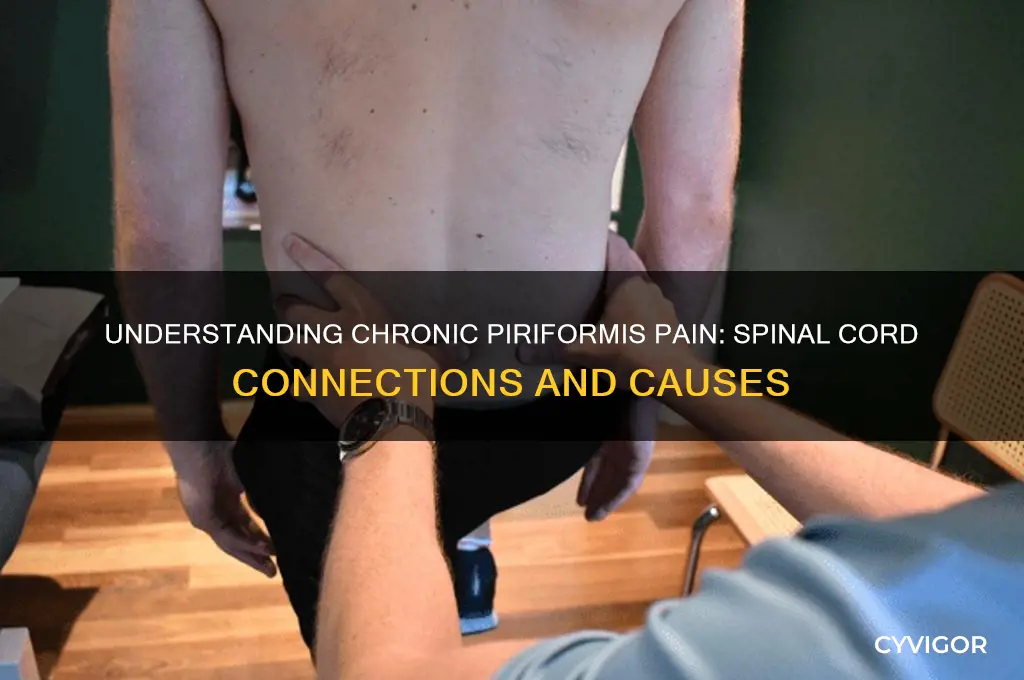 what causes chronic piriformis muscle pain at the spinal cord