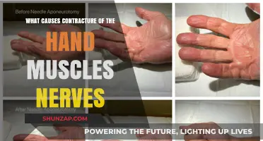 Understanding Hand Contracture: Causes of Muscle and Nerve Tightening