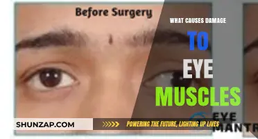 Understanding Eye Muscle Damage: Causes and Prevention Tips