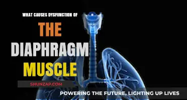 Understanding Diaphragm Dysfunction: Causes and Contributing Factors Explained