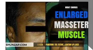 Understanding Enlarged Masseter Muscles: Causes, Symptoms, and Treatment Options