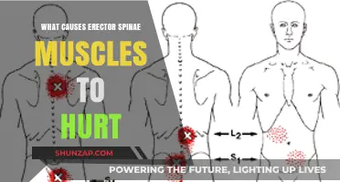 Why Your Erector Spinae Muscles Ache: Common Causes Explained