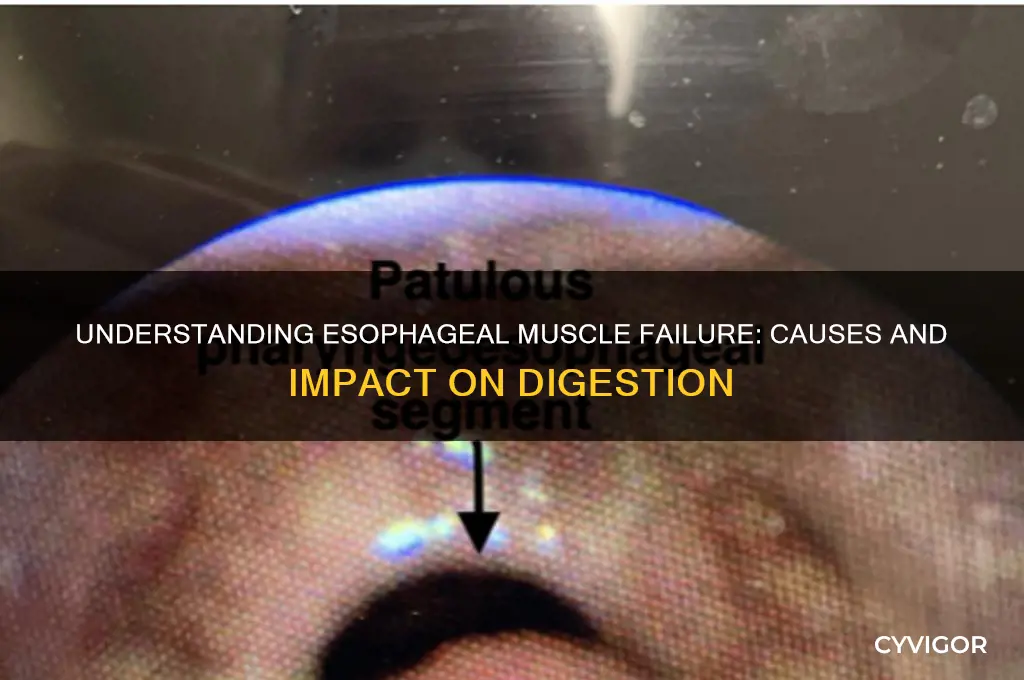 what causes esophagus muscles to stop working