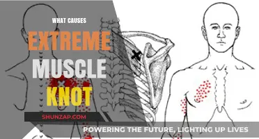 Unraveling the Mystery: What Causes Extreme Muscle Knots?