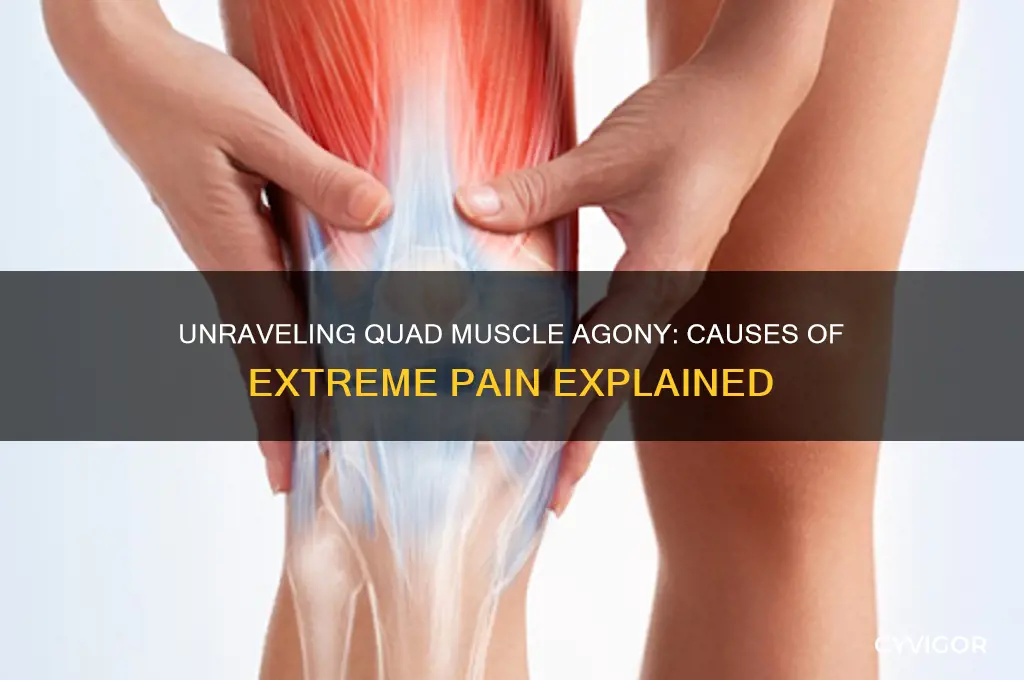 what causes extreme pain in the quad muscles