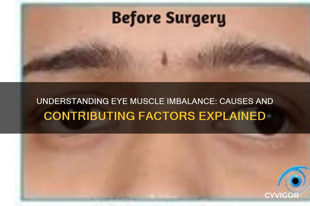 what causes eye muscle imbalance