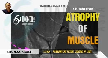 Understanding Fatty Atrophy: Causes of Muscle Degeneration Explained