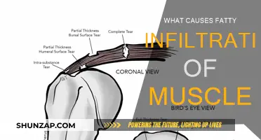 Muscle Fat Infiltration: Understanding the Underlying Causes