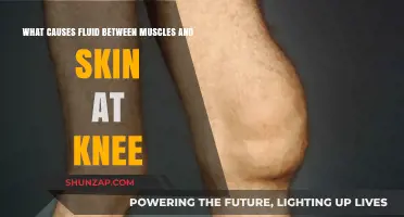 Understanding Knee Swelling: Causes of Fluid Buildup Under Skin