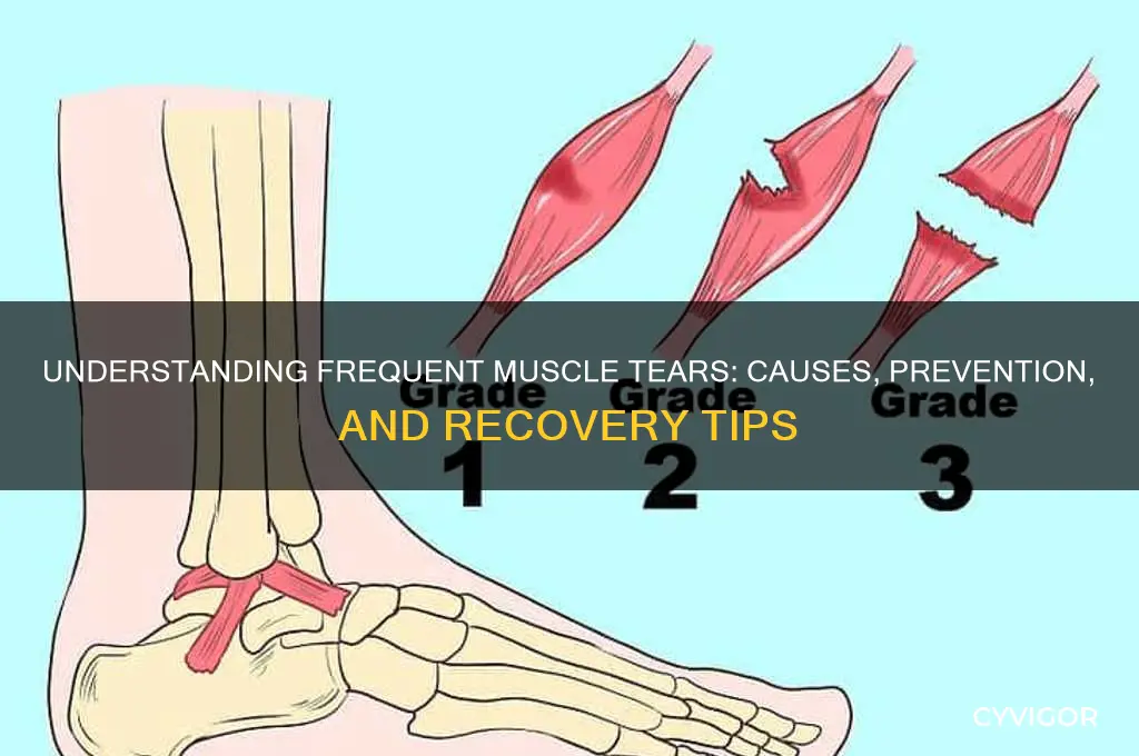 what causes frequent muscle tears