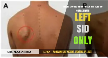 Left-Sided Front Neck Muscle Overactivation: Causes and Solutions Explained