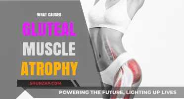 Understanding Gluteal Muscle Atrophy: Causes and Contributing Factors Explained