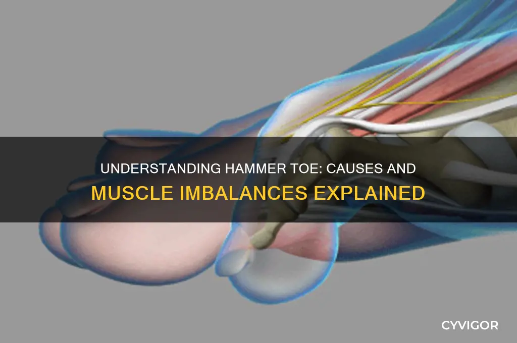 what causes hammer toe muscle