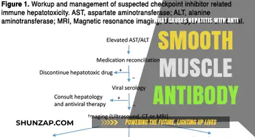 Understanding Hepatitis: The Role of Anti-Smooth Muscle Antibodies Explained