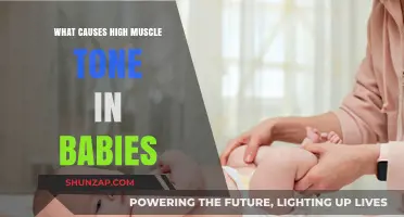 Understanding High Muscle Tone in Babies: Causes and Early Signs