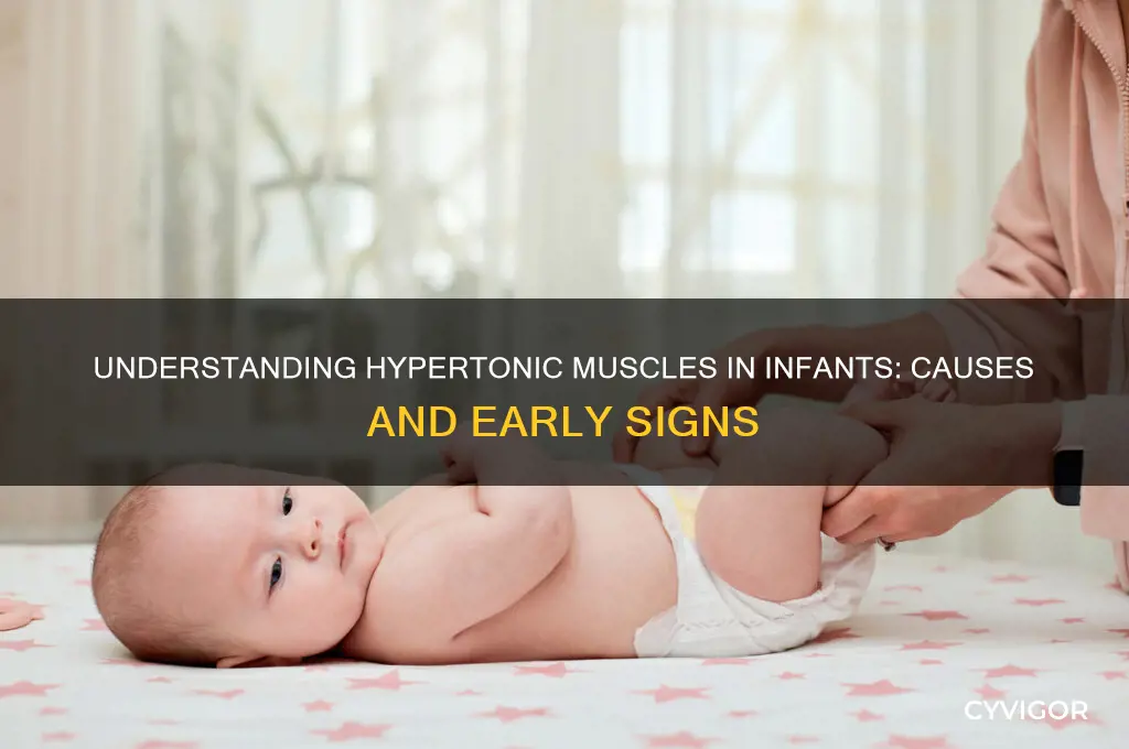 what causes hypertonic muscles in infants