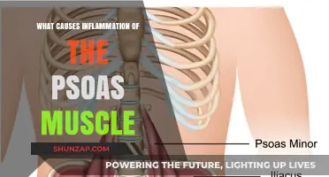 Understanding Psoas Muscle Inflammation: Causes, Symptoms, and Treatment Options