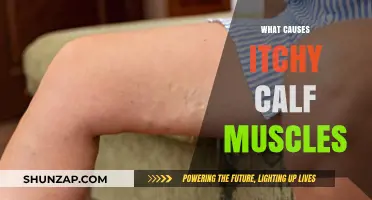 Why Do My Calf Muscles Itch? Causes and Remedies Explained