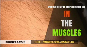 Understanding Tiny Muscle Bumps: Causes of Subcutaneous Skin Nodules