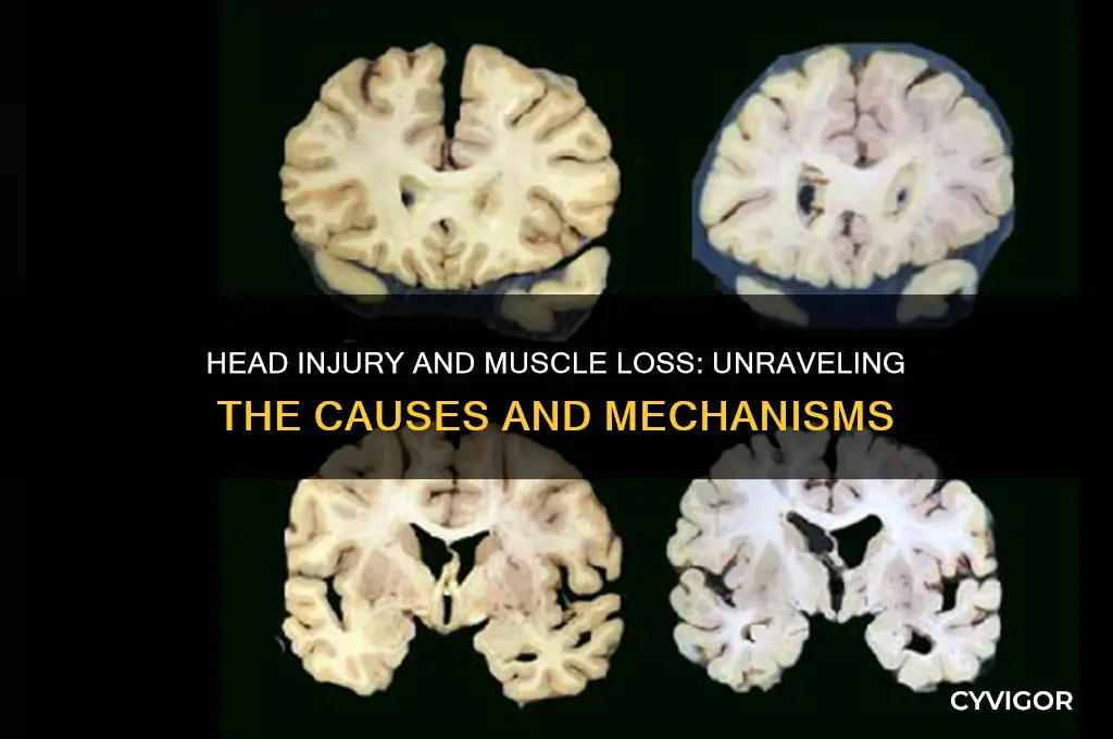 what causes loss of muscle mass after a head injury