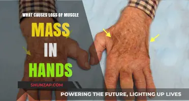 Understanding Hand Muscle Atrophy: Causes and Prevention Strategies