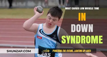 Understanding Low Muscle Tone in Down Syndrome: Causes and Insights