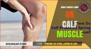 Understanding Calf Muscle Lumps: Causes, Symptoms, and Treatment Options